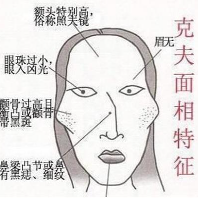 克夫相 快懂百科