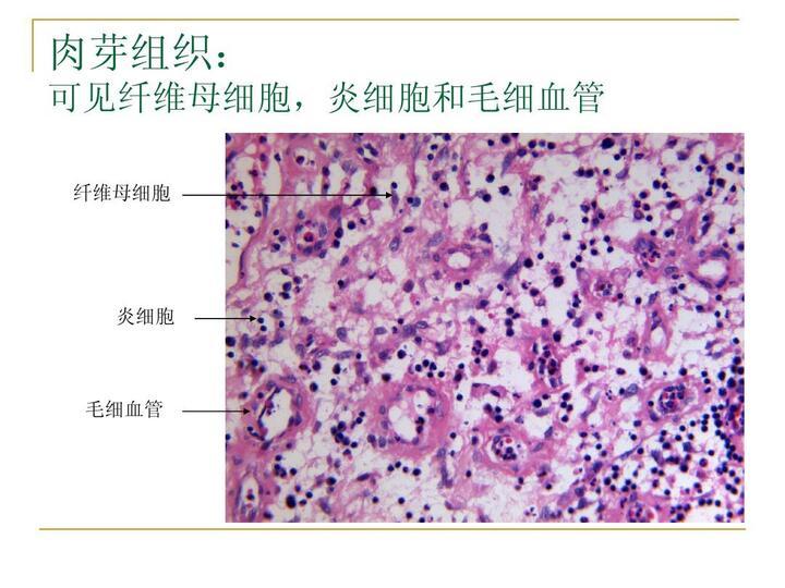 毛母细胞 快懂百科
