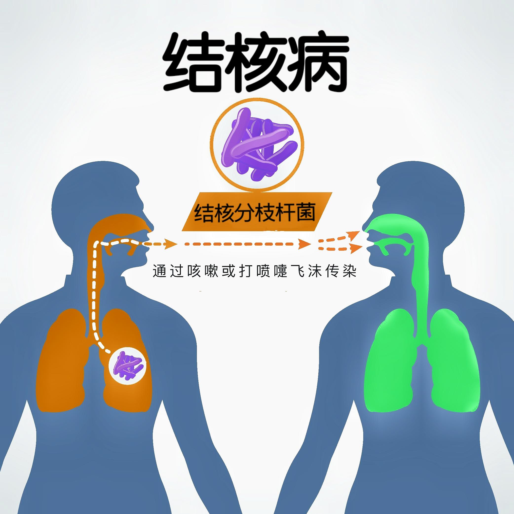 结核病 - 快懂百科