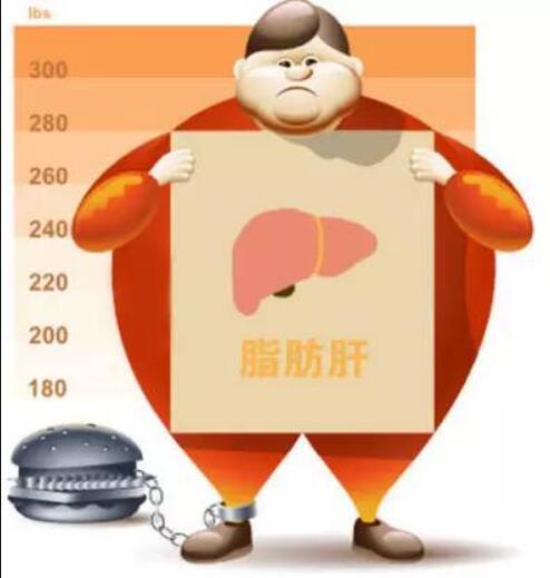 肥胖性脂肪肝- 快懂百科