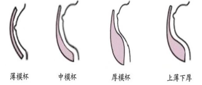 罩杯 - 快懂百科