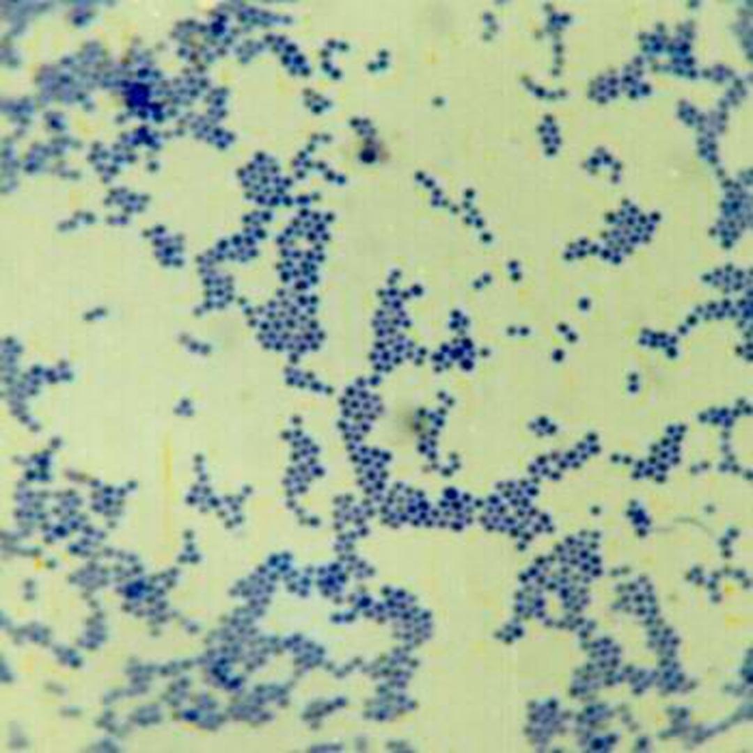 葡萄球菌革兰染色绘图图片